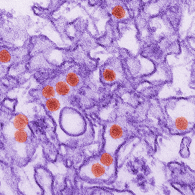 вирус гепатита В